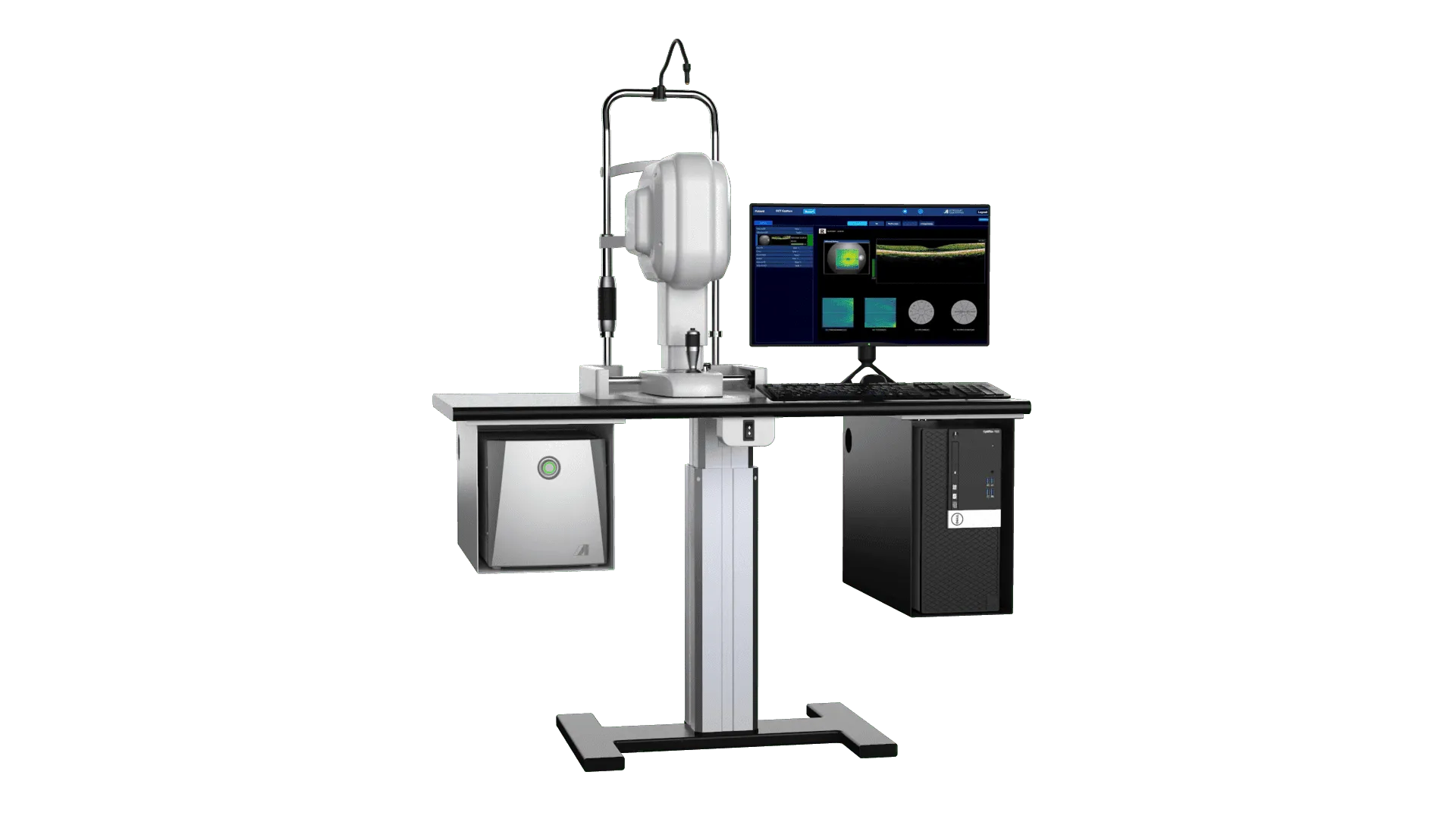 Optical Coherence Tomography Model: Appasamy Cıana — şəkil 3