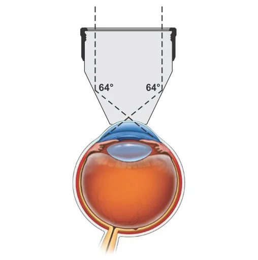 20D Aspheric Lens — şəkil 4